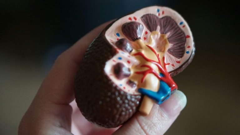 Silent Pandemic: Chronic Kidney Disease